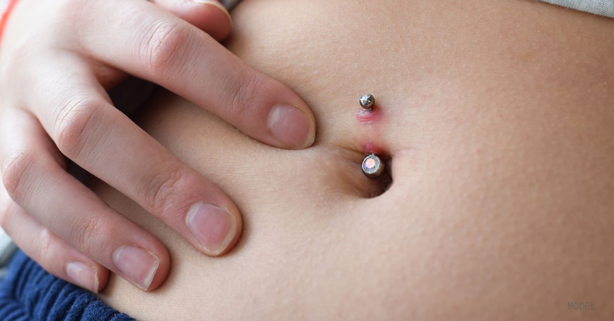 cfm-piercing-bump-vs-keloid-whats-the-difference-blog.jpg
